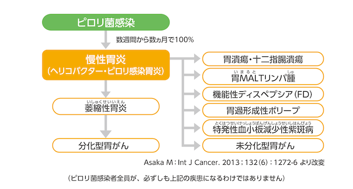 ADHD薬は不安を引き起こしますか