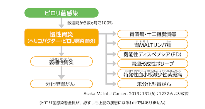 慢性胃炎 ピロリ菌と病気 ピロリ菌のお話 Jp