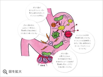 図：10年間で胃がんが発生した人の割合