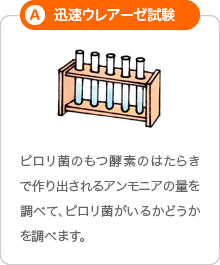 A「迅速ウレアーゼ試験」:ピロリ菌のもつ酵素のはたらきで作り出されるアンモニアの量を調べて、ピロリ菌がいるかどうかを判定します。