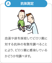 A「抗体測定」:血液や尿を採取してピロリ菌に対する抗体の有無を調べることにより、ピロリ菌に感染しているかどうかを判定します。